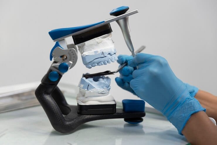 Dental Implants