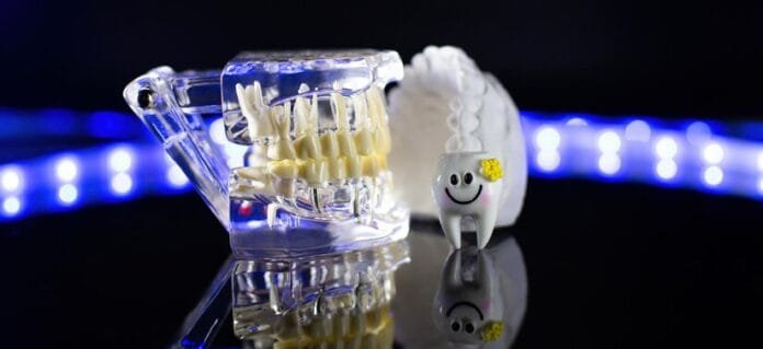 Straight Teeth, Straight to the Bank